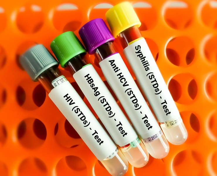 STD Checks at NSHC