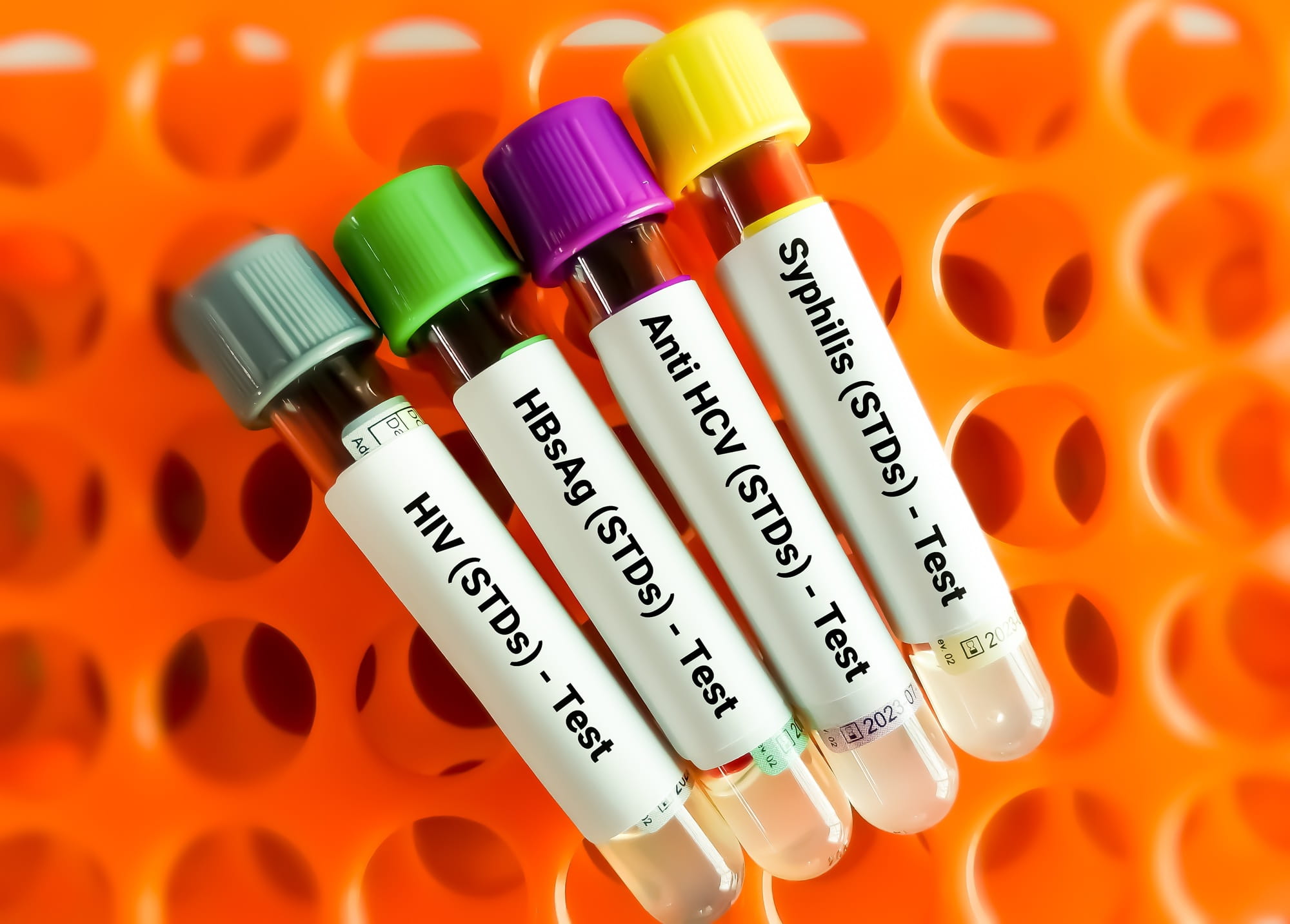 Tests to Check Sexually Transmitted Diseases