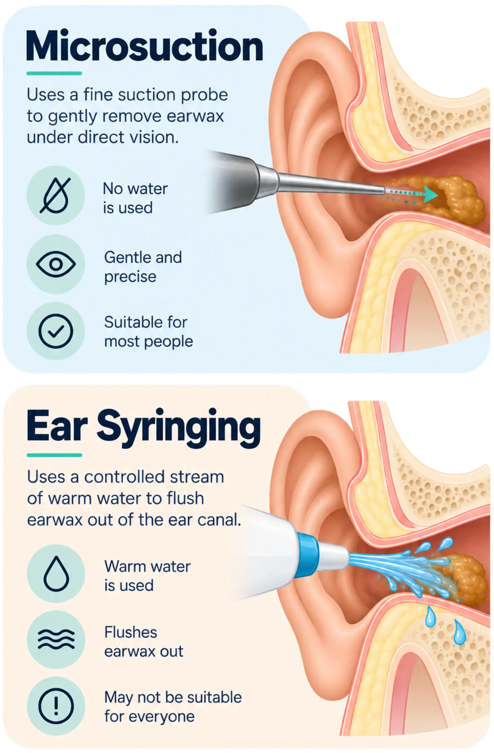 Microsuction Vs Ear Syringing